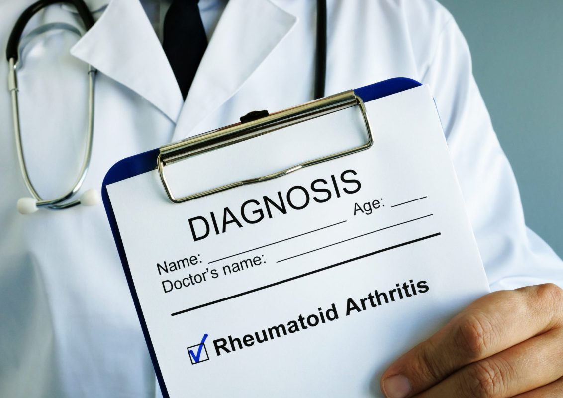 what are the early signs of rheumatoid arthritis